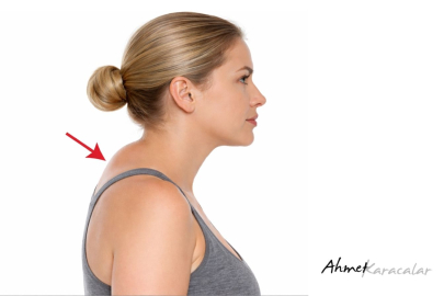 Gözden kaçan tehlikeli YAĞ ! - Ense Hörgücü